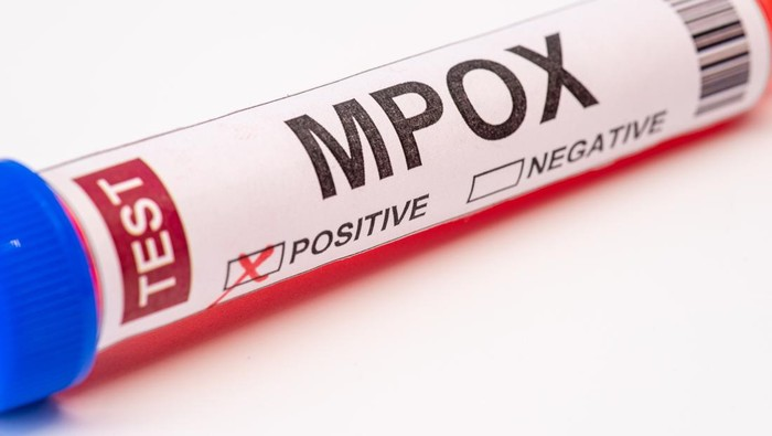 WHO Mendadak Rapat Darurat, Ini Kondisi Wabah Mpox yang Kasusnya Menanjak Lagi