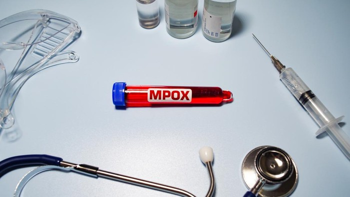 RI Mencatat ada 88 Kasus Mpox ‘Cacar Monyet’, Ini Sebaran Wilayahnya
