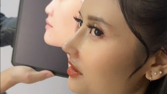 Wajah Selebgram Riyuka Bunga Kini Bikin Pangling Usai Operasi Hidung