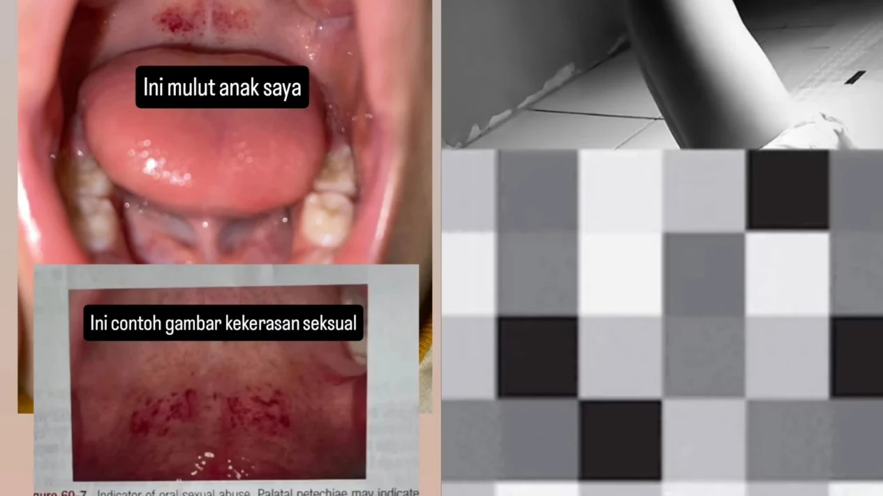 Biadab! Balita 2 Tahun Jadi Korban Cabul Bapak Kos, Warganet Geram 